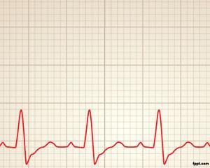 Plantilla PPT de Ritmo Cardiaco